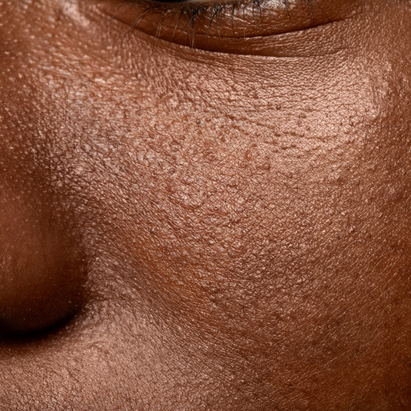 The best exfoliators for oily skin & how to use them